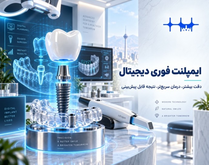 ایمپلنت فوری: راهنمای جامع کاشت دندان در یک روز
