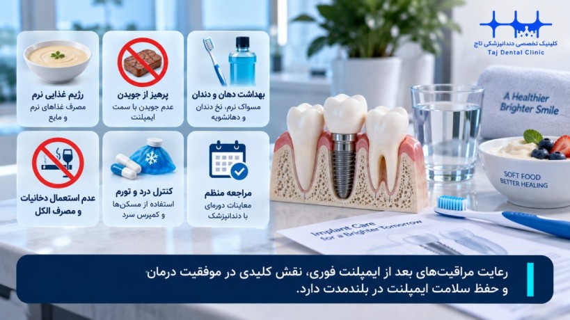 مراقبت‌های بعد از کاشت ایمپلنت فوری