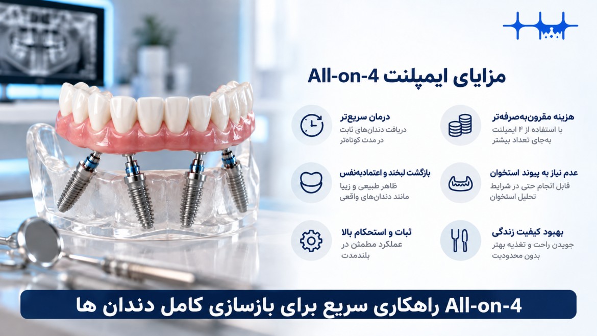 مزایای ایمپلنت فول موس