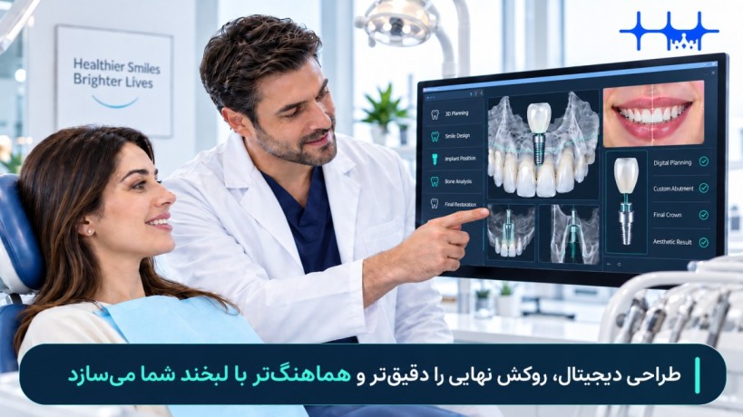 مزیت ایمپلنت دیجیتال
