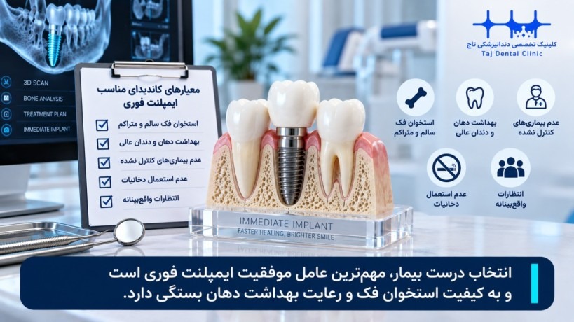 چه کسانی کاندید مناسبی برای ایمپلنت فوری هستند