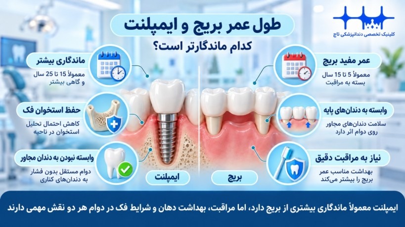 طول عمر بریج و ایمپلنت؛ کدام ماندگارتر است