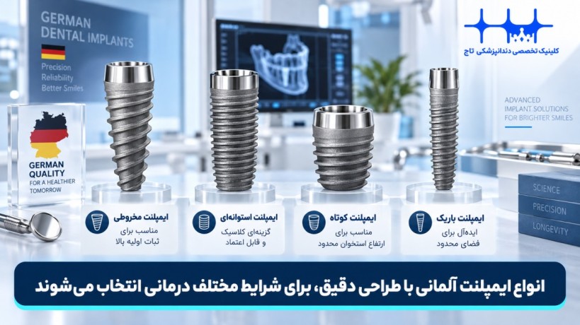 انواع ایمپلنت آلمانی