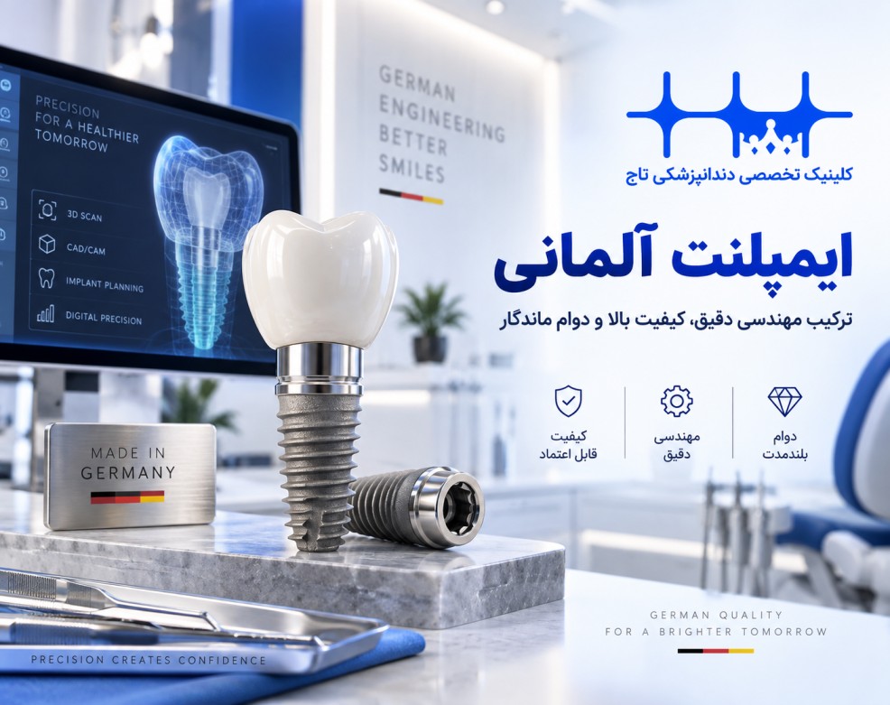 ایمپلنت آلمانی: راهنمای جامع کیفیت، قیمت و بهترین برندها