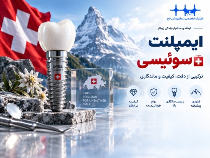 ایمپلنت سوئیسی: معیاری برای کیفیت و دوام در دنیای دندانپزشکی