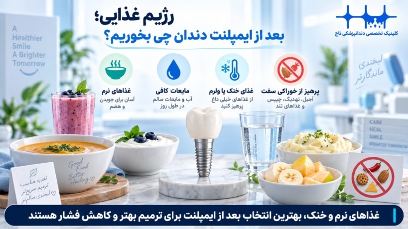 بعد از ایمپلنت دندان چی بخوریم