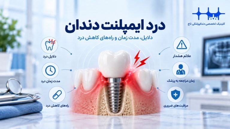 درد ایمپلنت دندان: علل، شدت، مدت زمان و راهکارهای کاهش آن