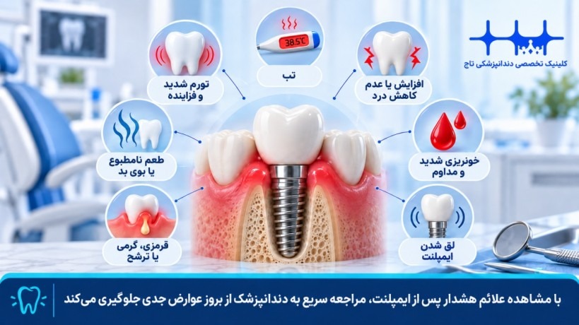علائم هشدار بعد از کاشت ایمپلنت دندان