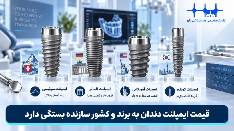 قیمت ایمپلنت دندان بر اساس برند و کشور سازنده