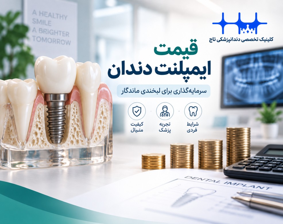 قیمت ایمپلنت دندان در سال ۱۴۰۵؛ جدول کامل هزینه ایمپلنت، روکش و درمان‌های جانبی