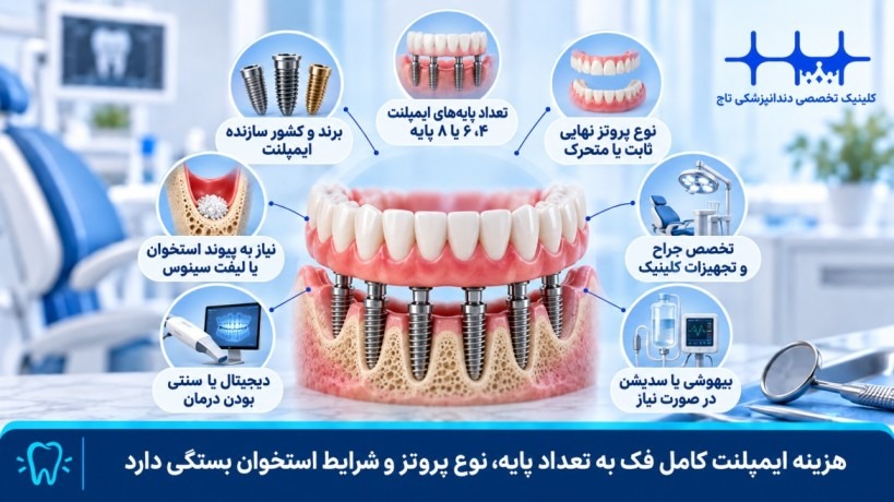 قیمت ایمپلنت کامل فک