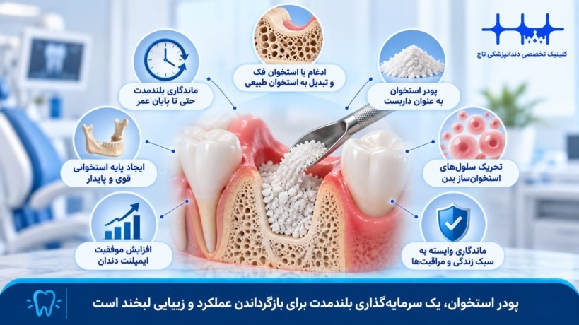 ماندگاری پودر استخوان در فک