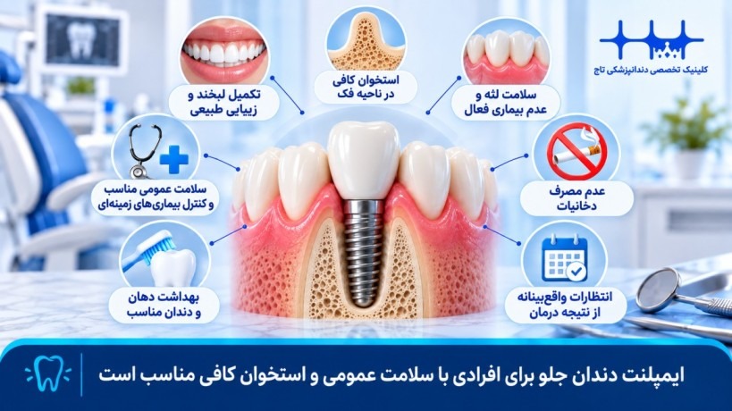 چه کسانی کاندید مناسبی برای ایمپلنت دندان جلو هستند